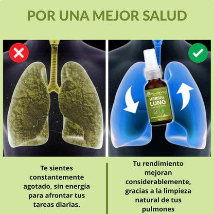 HERBAL LUNG™ | Limpieza Pulmonar Natural y Efectiva
